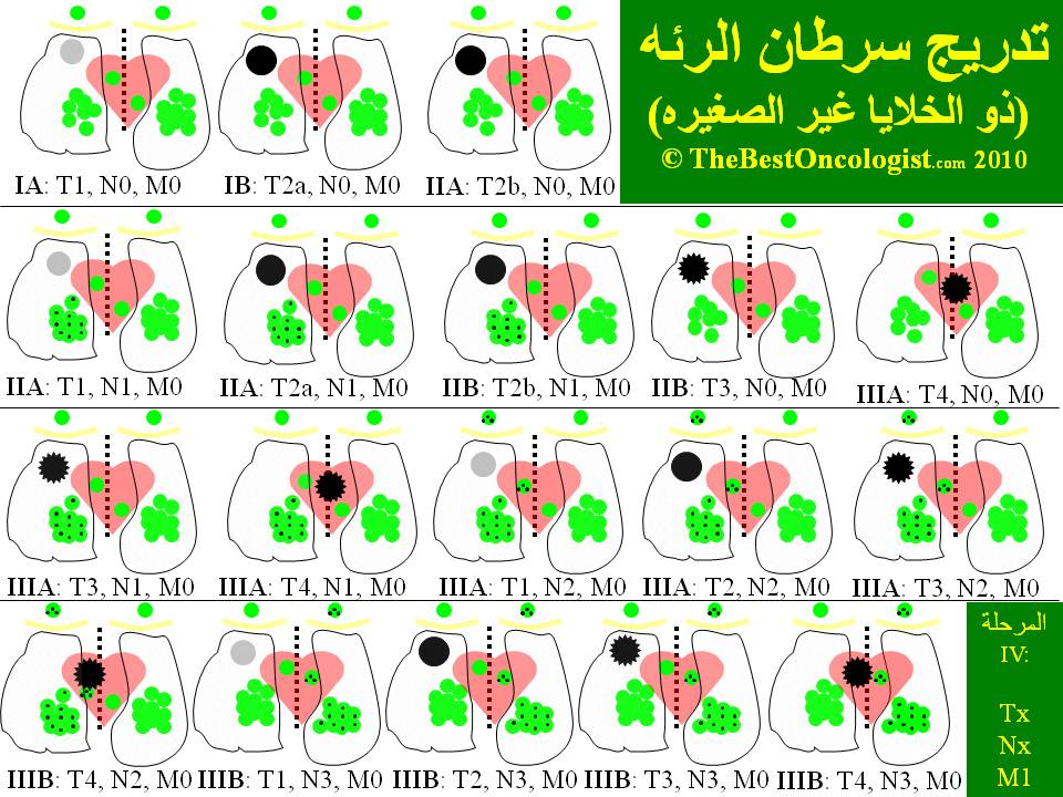 درجات سرطان الرئه