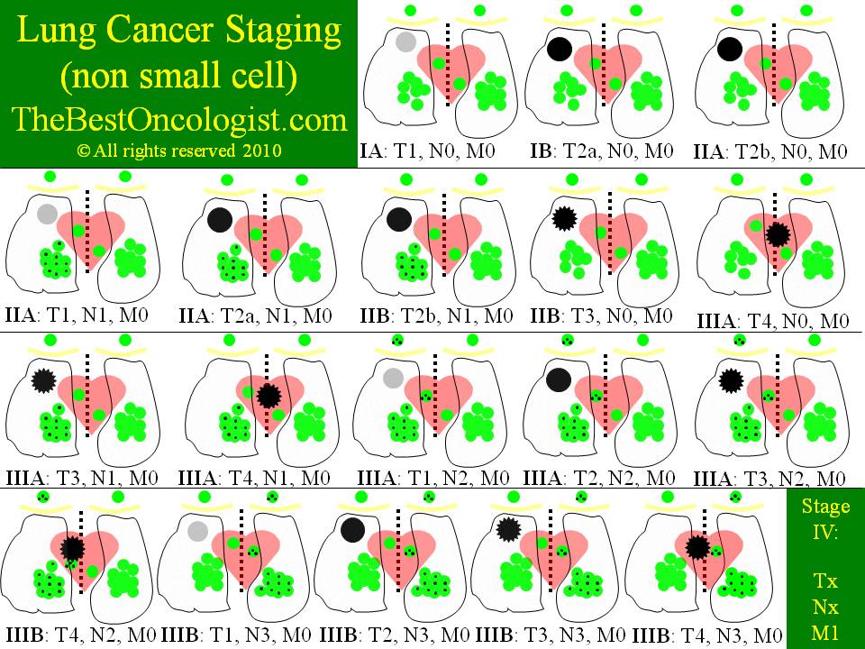 Lung cancer staging
