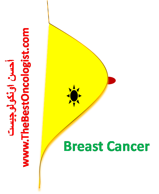 breast cancer سرطان الثدي