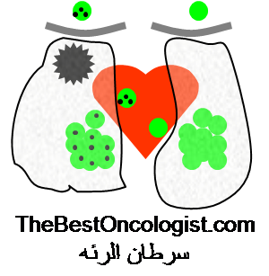 سرطان الرئة